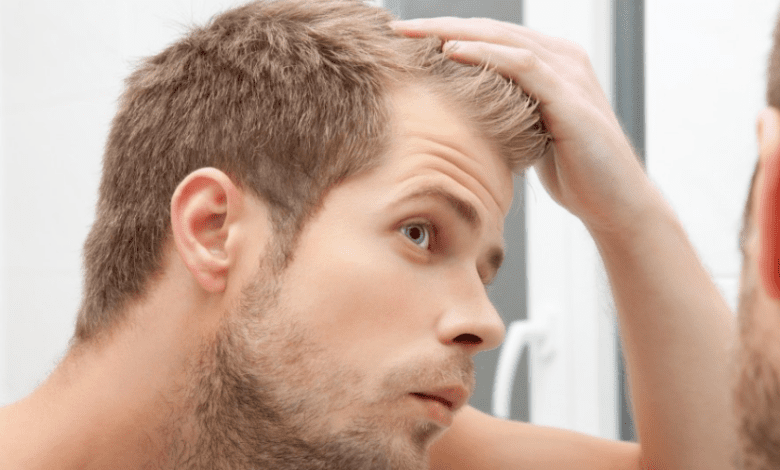 فوائد زيت الخروع للشعر