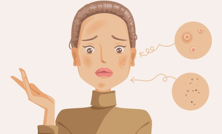 التخلص من الندبات واثر الحبوب